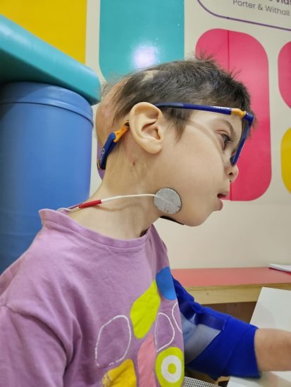 Fonoaudiologia - Eletroestimulação -habilistar (31) (1)