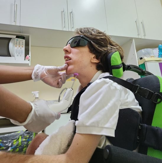 laserterapia-habilistar (2)